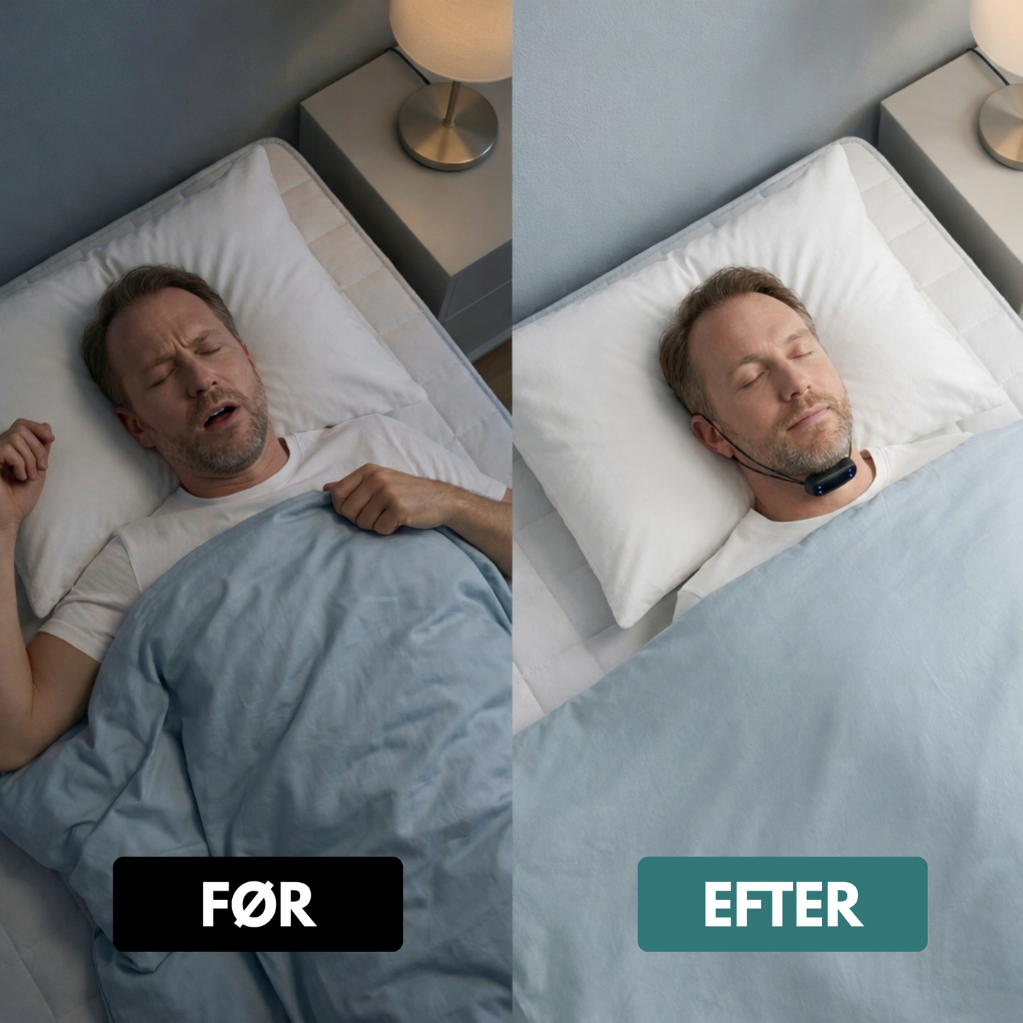 Corevion™ EMS Anti-Snore Device